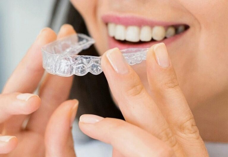 A young women holding a clear plastic aligner in front of her face.