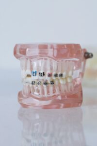 An image featuring invisalign and brace models with a white background.