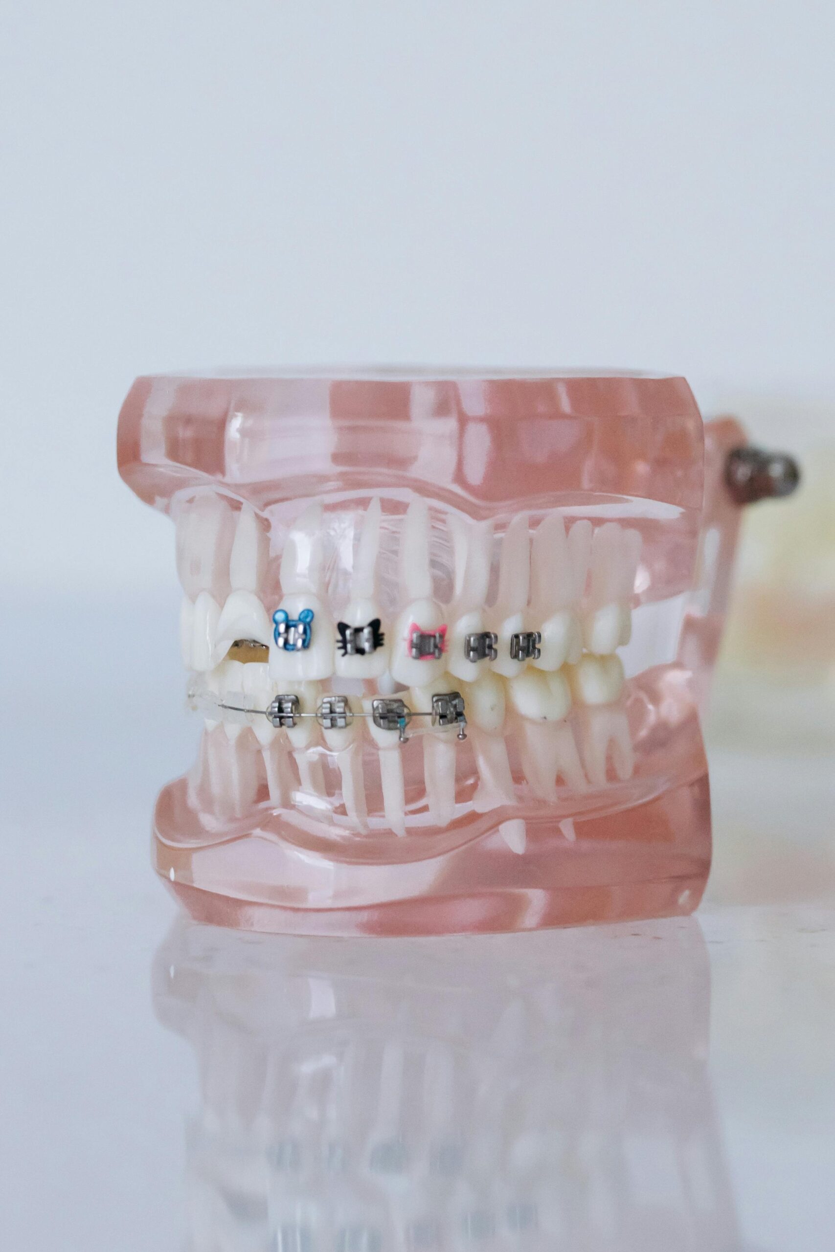 An image featuring invisalign and brace models with a white background.