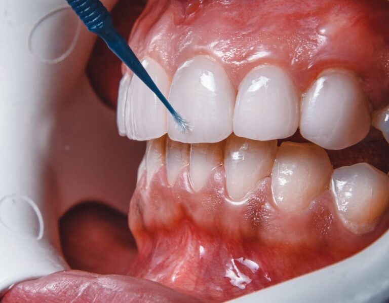Close-up of teeth during a dental procedure.