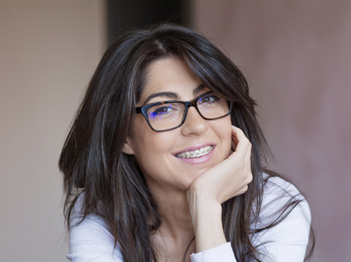 A smiling woman with long dark hair, wearing glasses and braces, resting her chin on her hand. Woman with braces and glasses smiling.