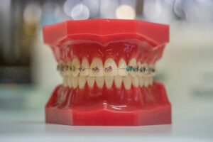 National Orthodontic Health Month braces feature.