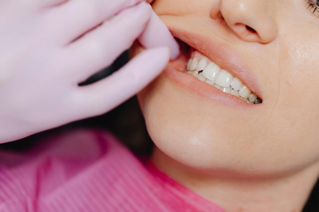 Adult smiling with clear braces during orthodontic treatment